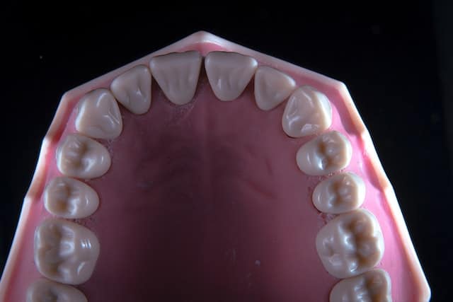 implant dentar Fast & Fixed