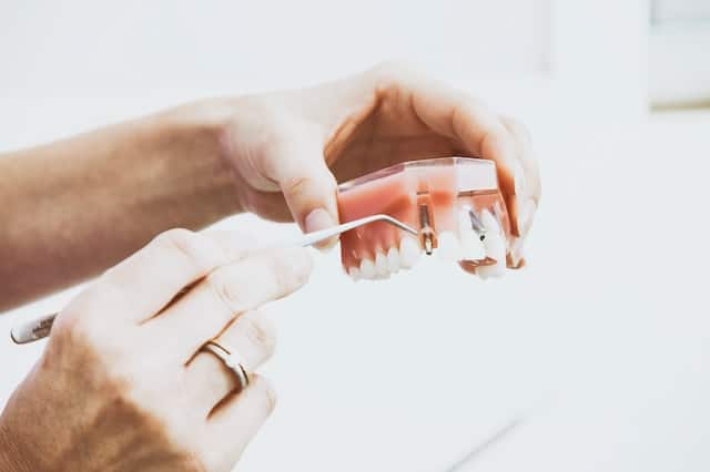 implant dentar fast&fixed