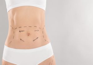 remodelare corporala in Bucuresti